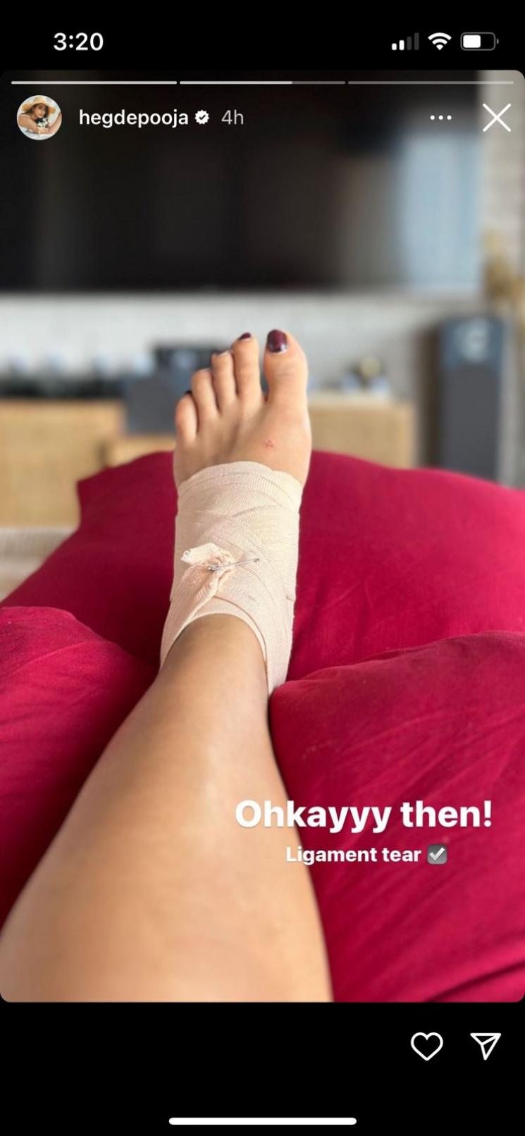 actress pooja hegde ligament tear in leg fans wish speedy recovery